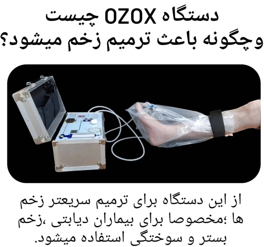 دستگاه ozox چیست و چگونه باعث ترمیم زخم می شود؟